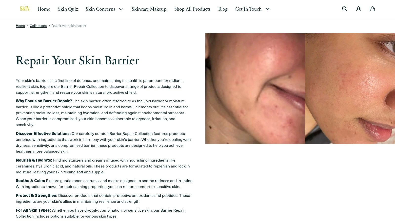 Harmony Skin website screenshot showing a collection of barrier repair products.