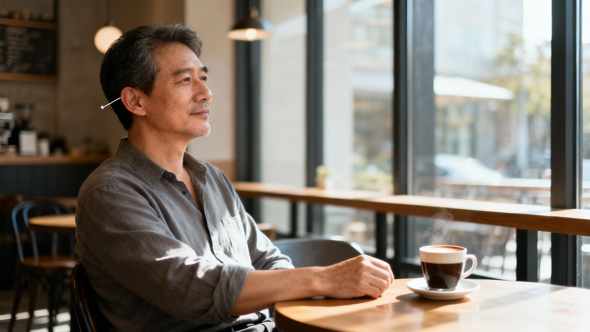 Une personne détendue lors d'une séance d'acupuncture, symbolisant le calme retrouvé.