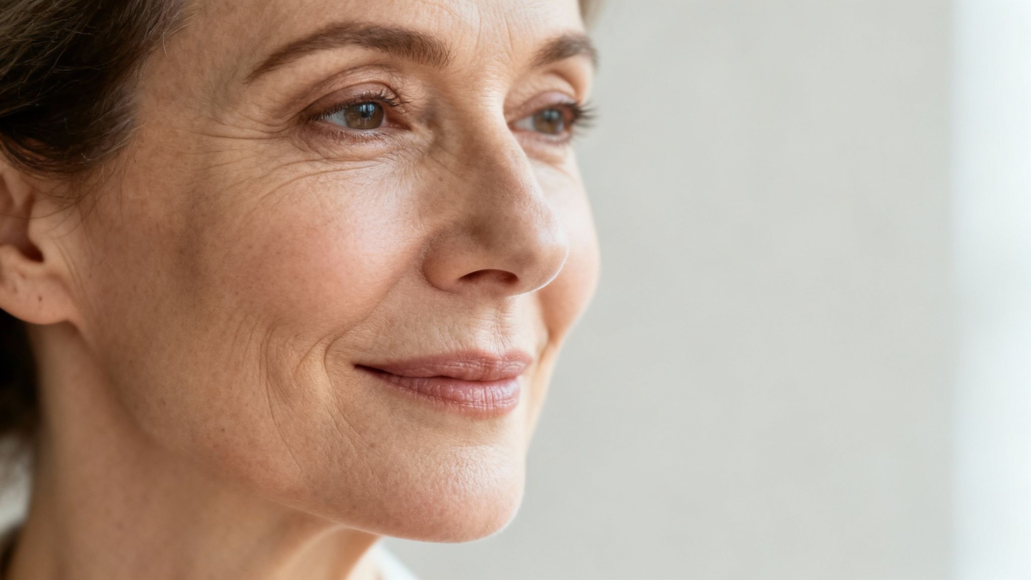 A person's face showing marionette lines extending from the corners of the mouth to the chin.