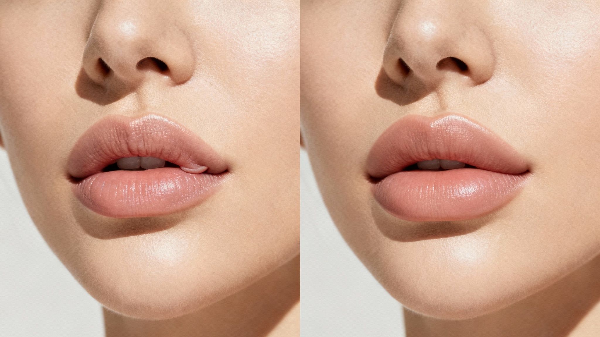 Close-up of a woman's lips before and after a lip flip treatment, showing increased volume and smoothness.