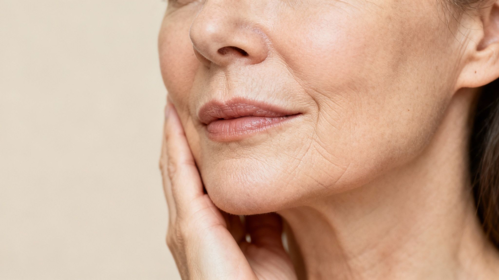 A woman's face showing marionette lines extending from the corners of her mouth downwards.