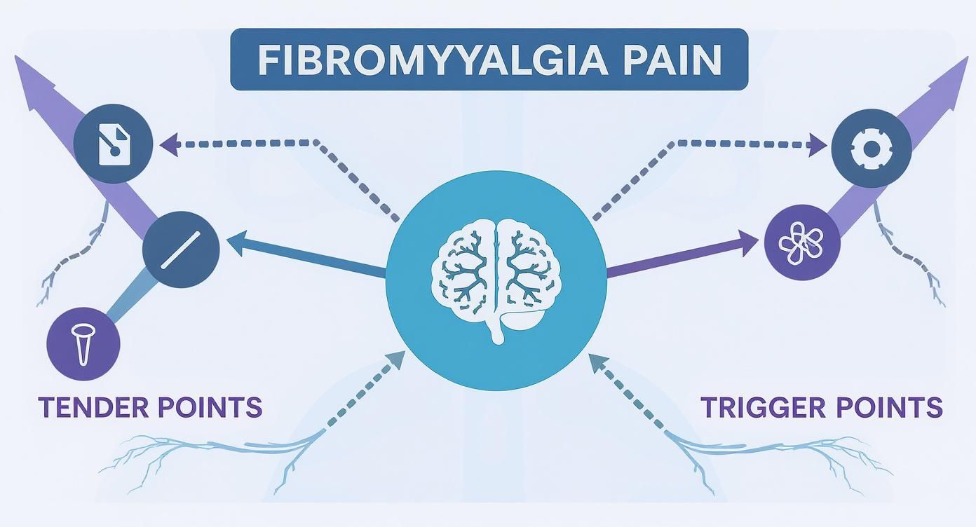 Infographic about trigger points for fibromyalgia