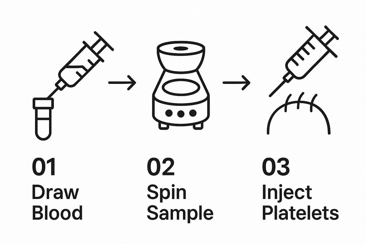 Infographic about what is prp for hair
