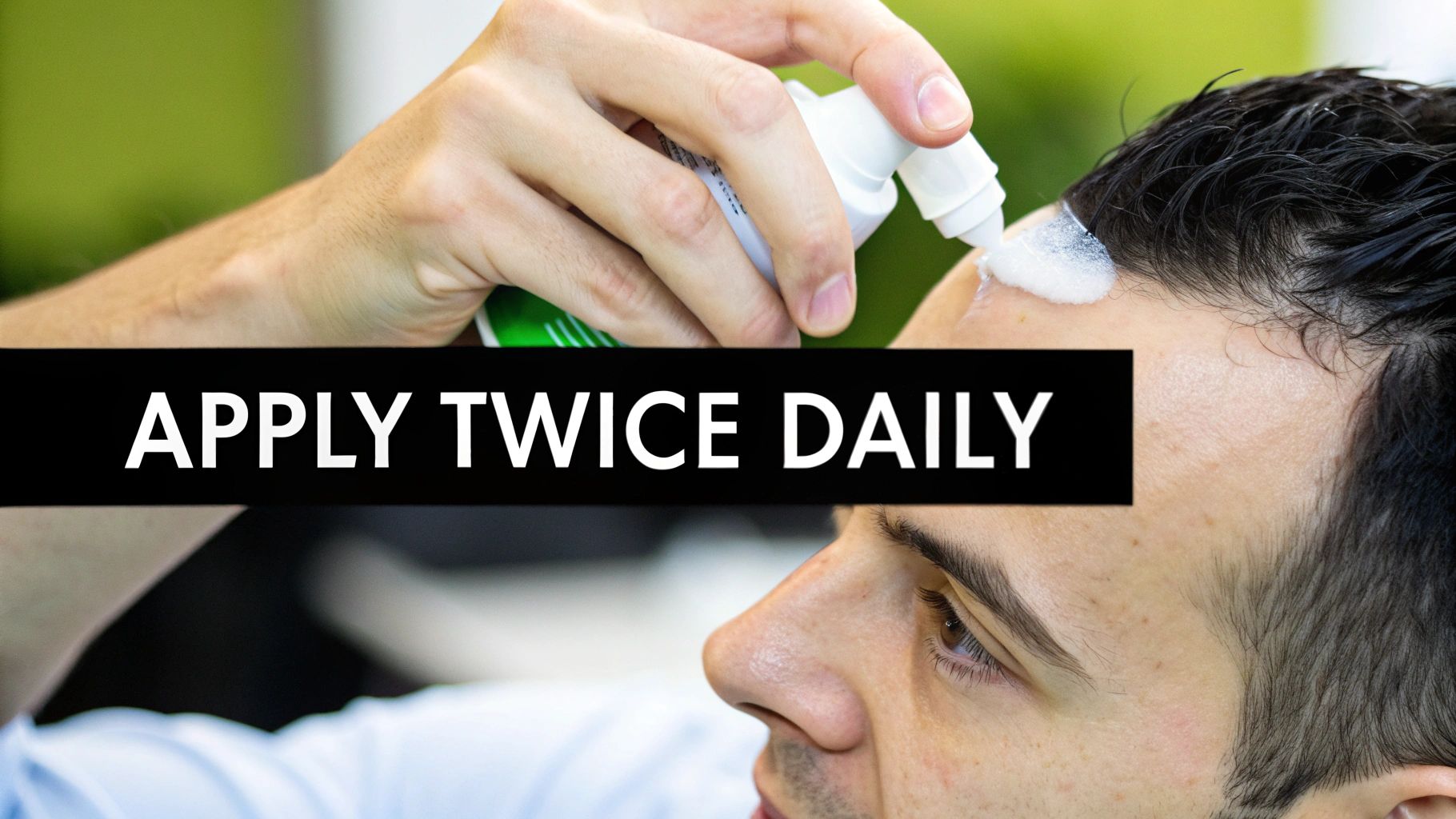 A man applies minoxidil foam to his hairline, with text 'APPLY TWICE DAILY' overlay.