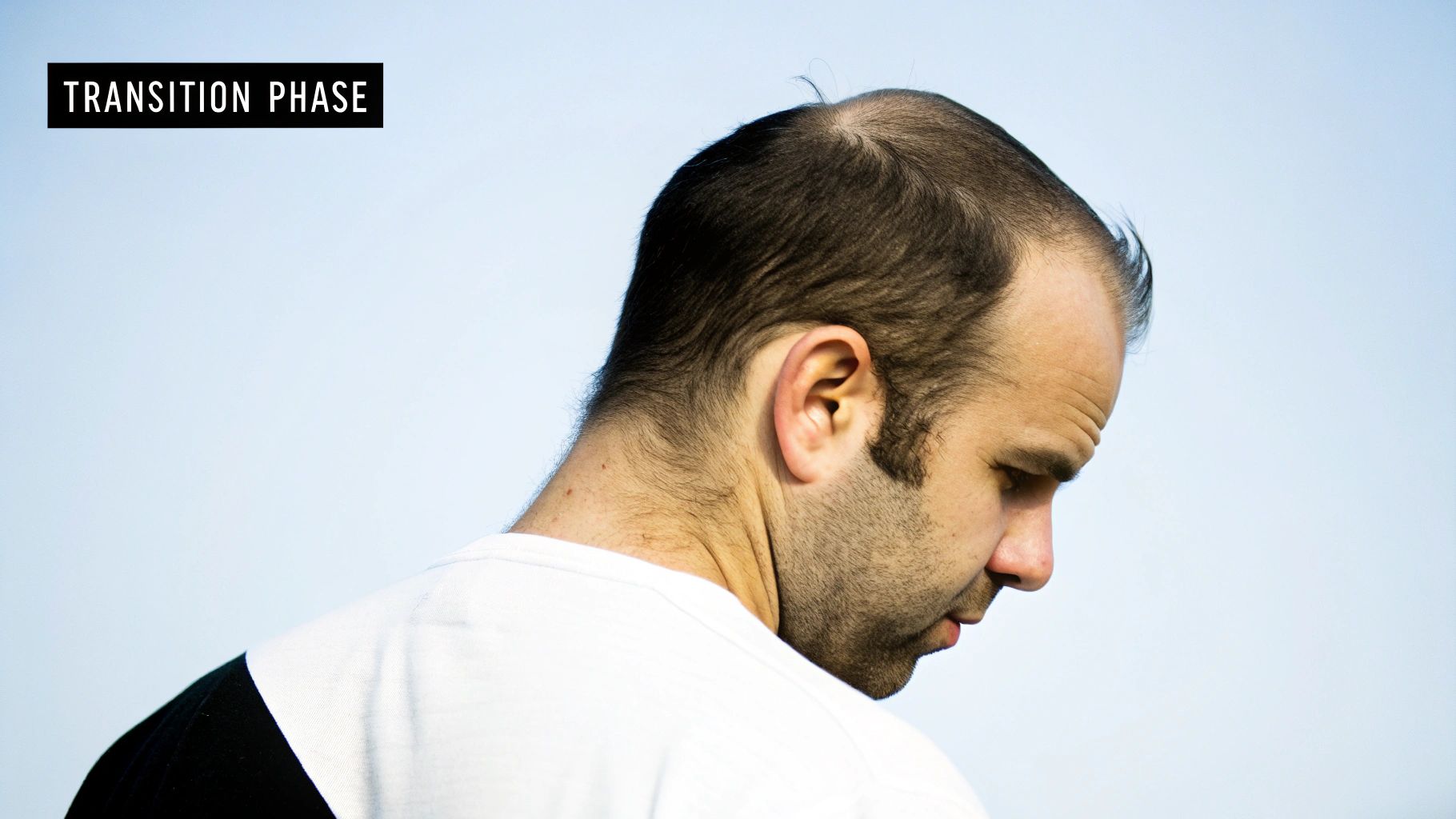 A man with a receding hairline and thinning hair, looking down. Text reads 'TRANSITION PHASE'.