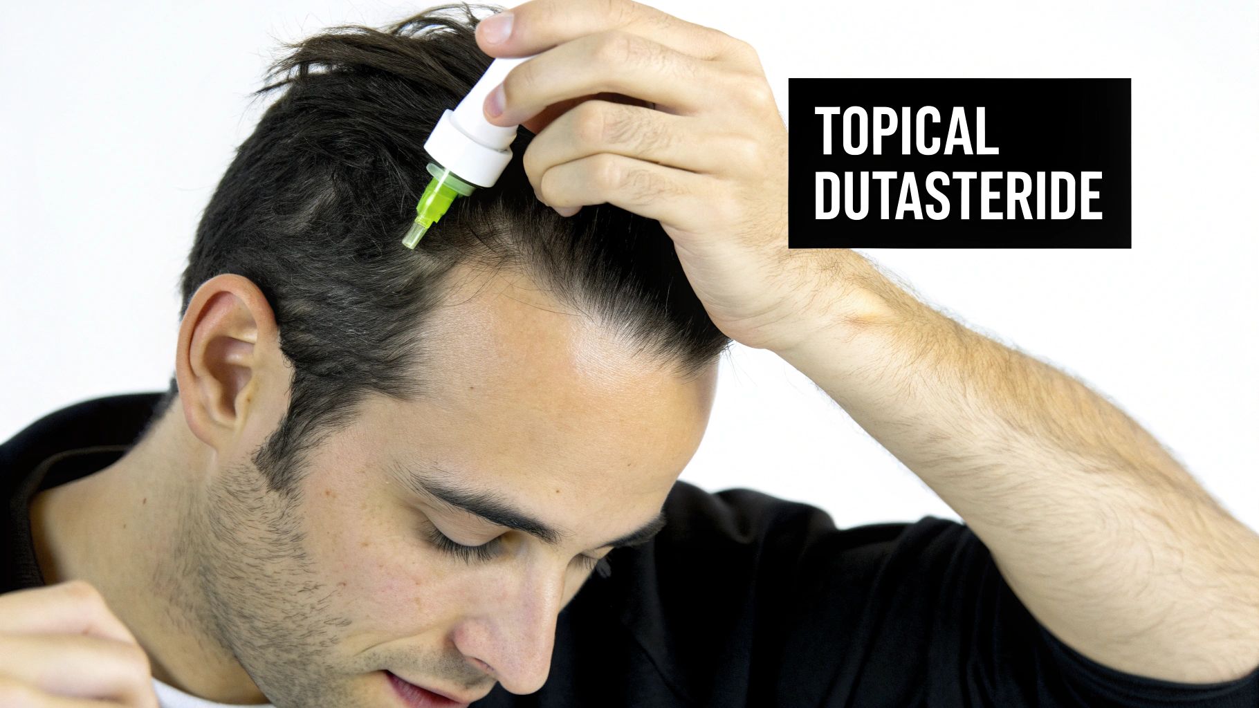 A person applying topical dutasteride solution to their scalp as a hair loss treatment.