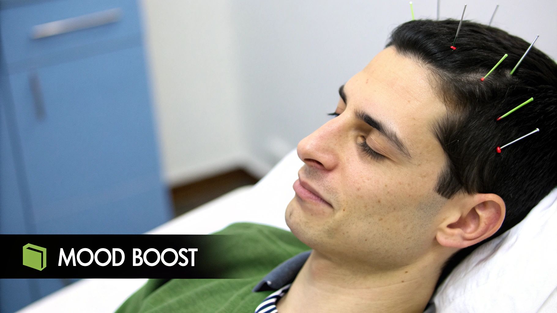 Benefits of Acupuncture for Anxiety | Discover Natural Relief An infographic illustrating how acupuncture needles stimulate points on the body, leading to the release of serotonin and dopamine in the brain, improving mood.
