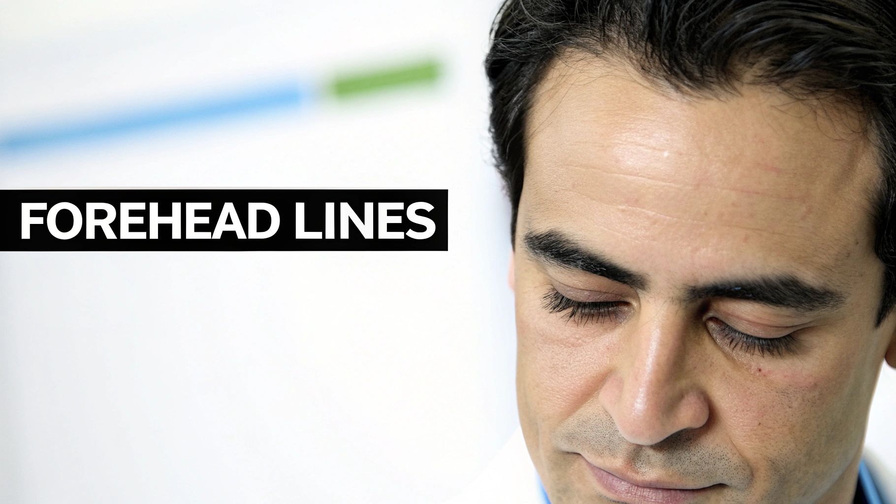 Close-up of a man with visible forehead lines, looking down, with text 'FOREHEAD LINES'.